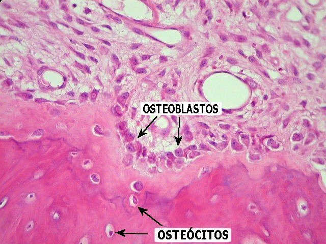 Osteoblasty puzzle online